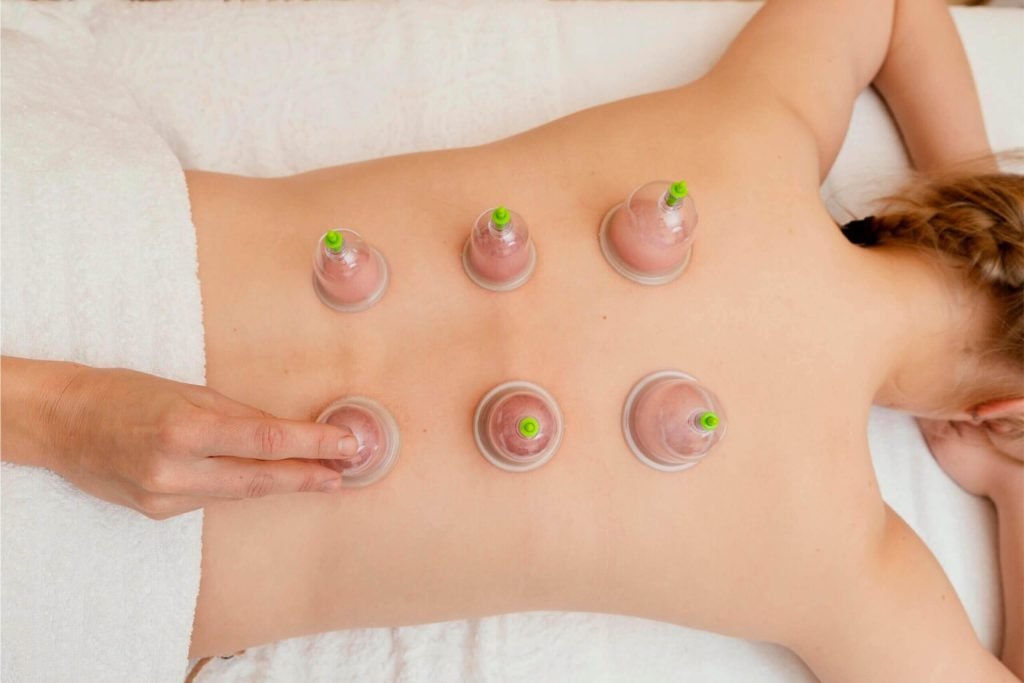 Service: Biomagnetic Sports Ortho Cupping - 01